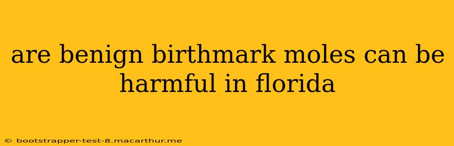 are benign birthmark moles can be harmful in florida