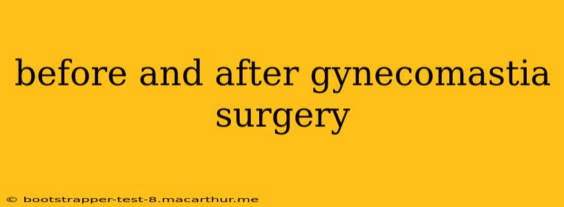 before and after gynecomastia surgery