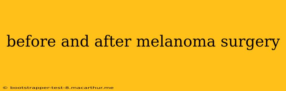 before and after melanoma surgery