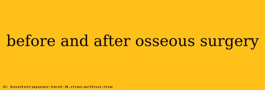 before and after osseous surgery