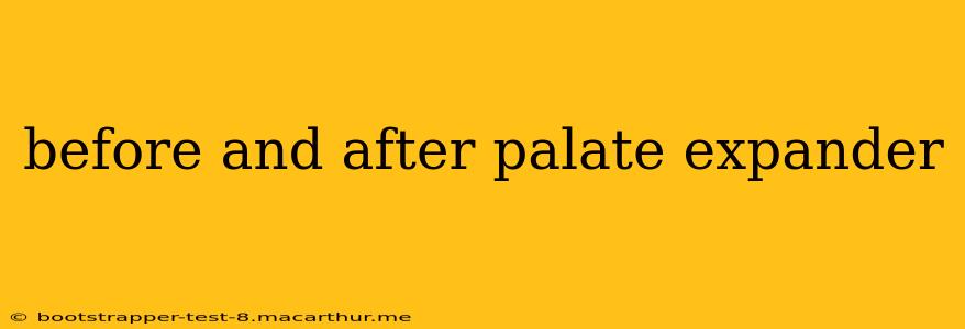 before and after palate expander