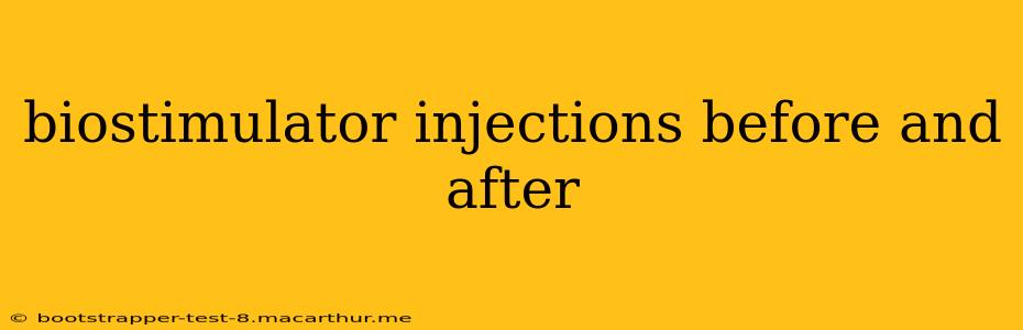 biostimulator injections before and after
