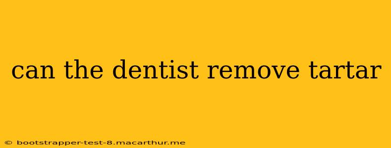 can the dentist remove tartar
