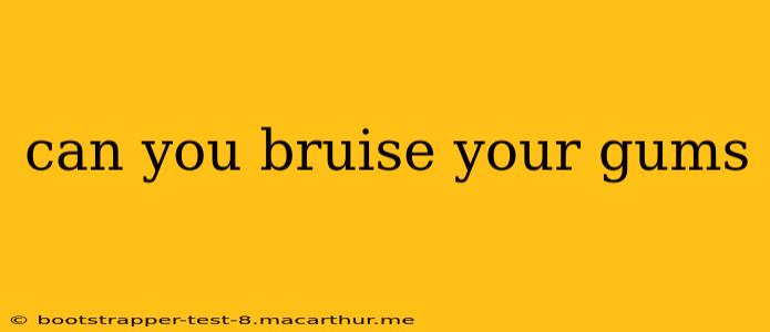 can you bruise your gums