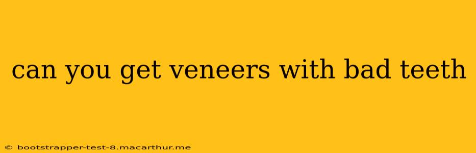 can you get veneers with bad teeth