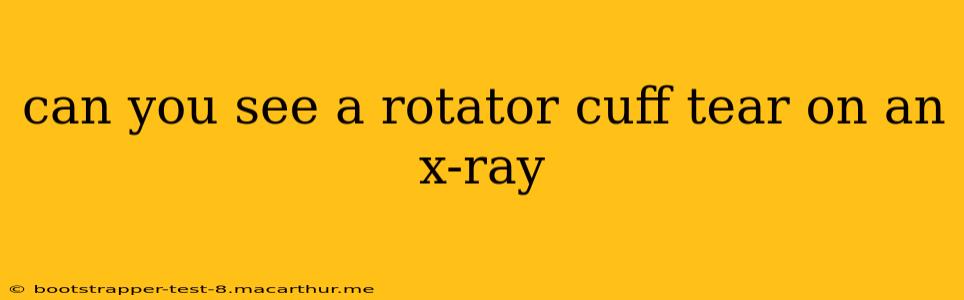 can you see a rotator cuff tear on an x-ray
