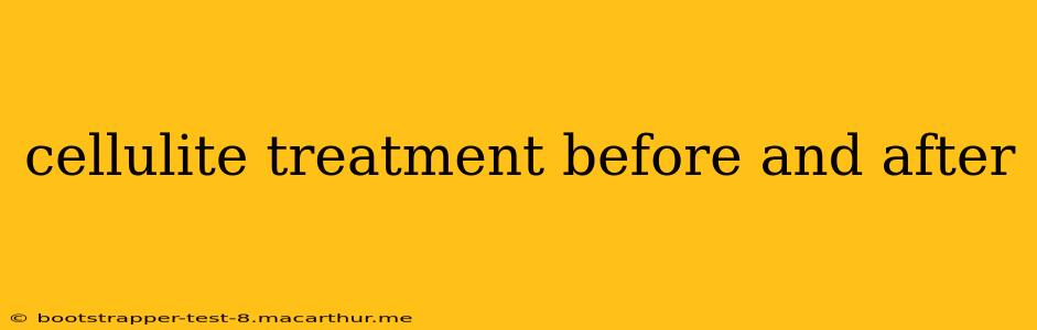 cellulite treatment before and after
