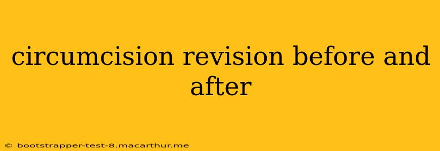 circumcision revision before and after