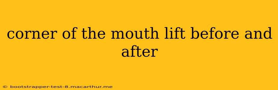 corner of the mouth lift before and after