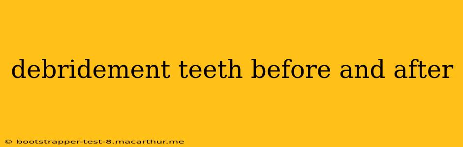 debridement teeth before and after