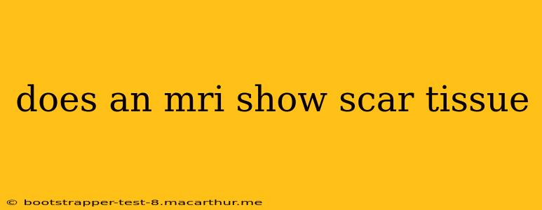 does an mri show scar tissue