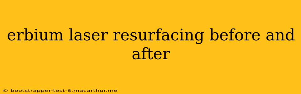 erbium laser resurfacing before and after