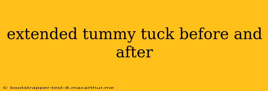 extended tummy tuck before and after