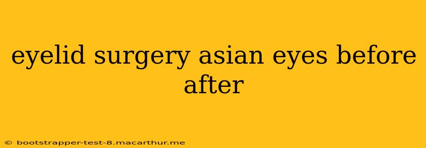 eyelid surgery asian eyes before after