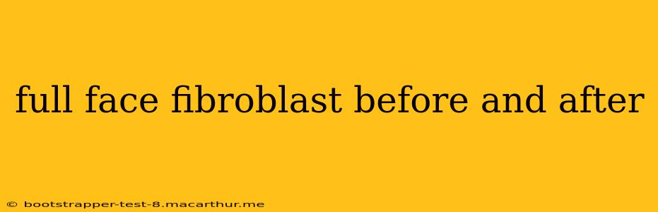 full face fibroblast before and after