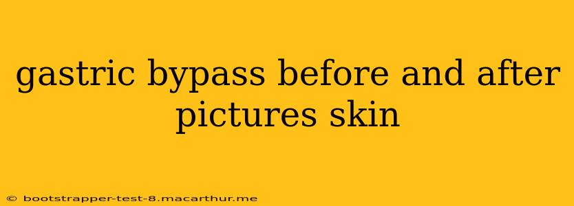 gastric bypass before and after pictures skin