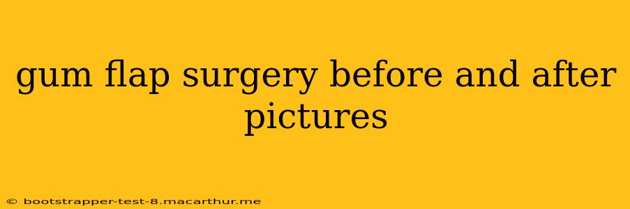 gum flap surgery before and after pictures