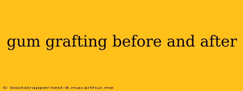 gum grafting before and after