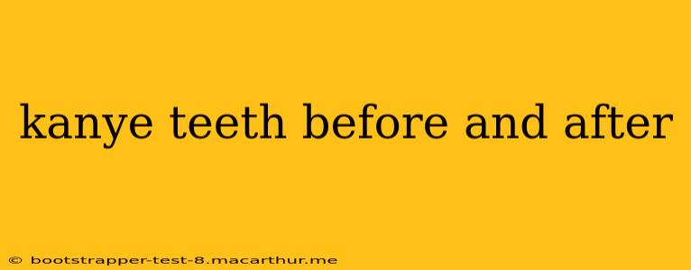 kanye teeth before and after