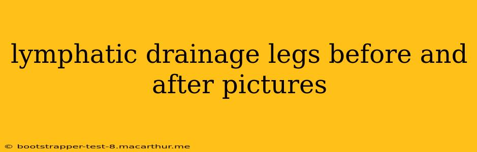 lymphatic drainage legs before and after pictures