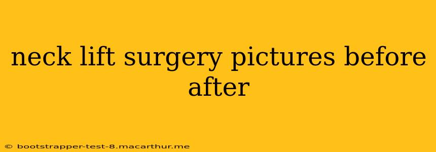 neck lift surgery pictures before after