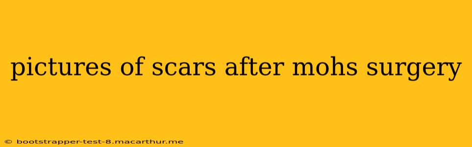 pictures of scars after mohs surgery