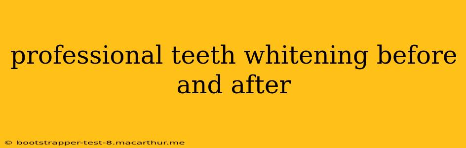 professional teeth whitening before and after