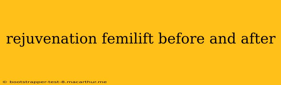 rejuvenation femilift before and after