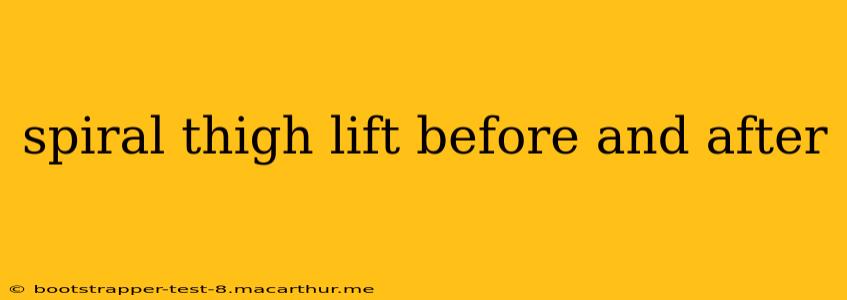 spiral thigh lift before and after