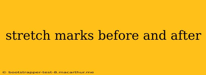 stretch marks before and after
