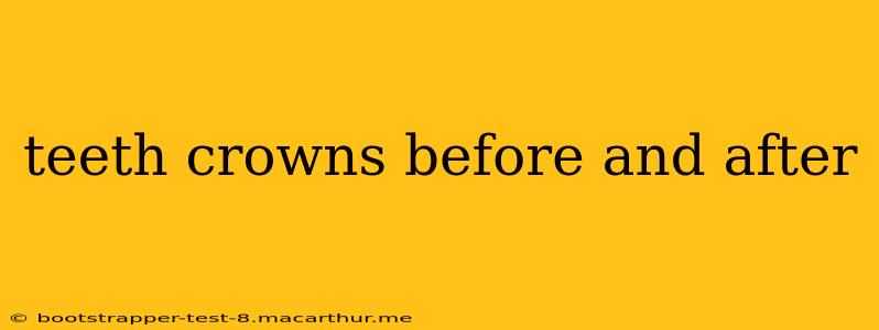 teeth crowns before and after