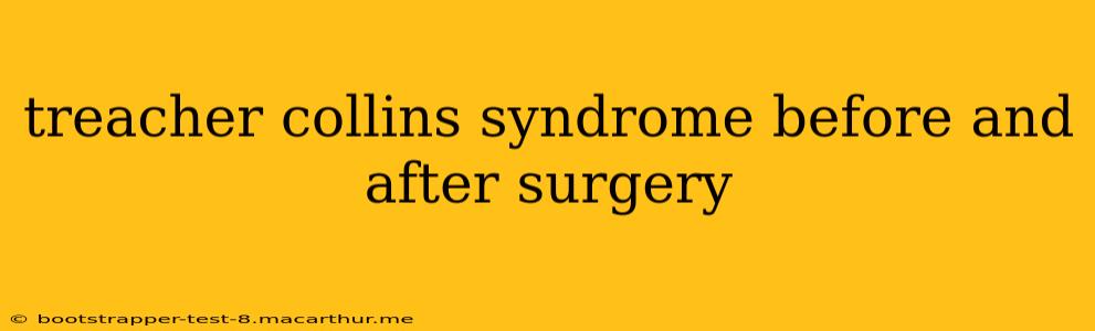 treacher collins syndrome before and after surgery