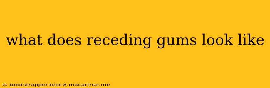 what does receding gums look like