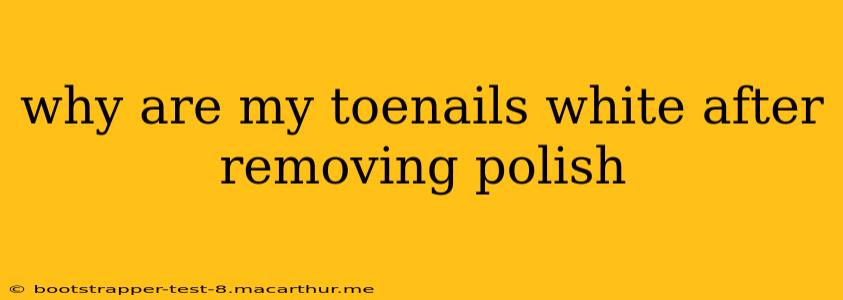 why are my toenails white after removing polish