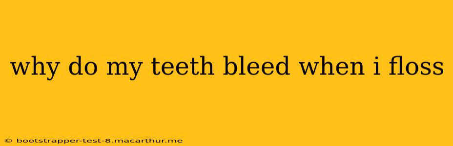 why do my teeth bleed when i floss